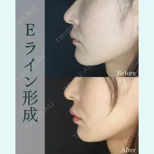 L‘amour clinic Tokyo【ラムールクリニック東京】の症例
