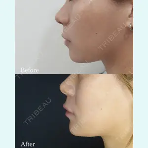 L‘amour clinic Tokyo【ラムールクリニック東京】の症例