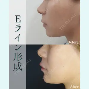 L‘amour clinic Tokyo【ラムールクリニック東京】の症例