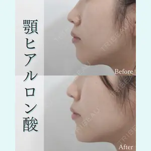 L‘amour clinic Tokyo【ラムールクリニック東京】の症例