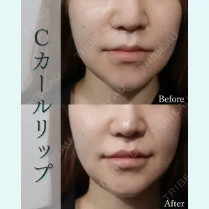 L‘amour clinic Tokyo【ラムールクリニック東京】の症例
