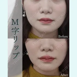 L‘amour clinic Tokyo【ラムールクリニック東京】の症例