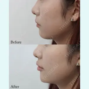 L‘amour clinic Tokyo【ラムールクリニック東京】の症例