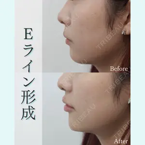 L‘amour clinic Tokyo【ラムールクリニック東京】の症例