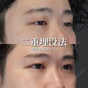 ライブリークリニック 船橋院 坂田 将彰医師の症例