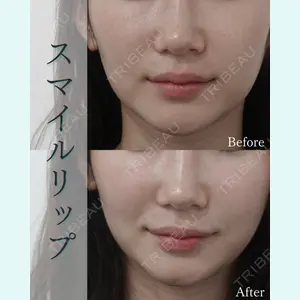 L‘amour clinic Tokyo【ラムールクリニック東京】の症例