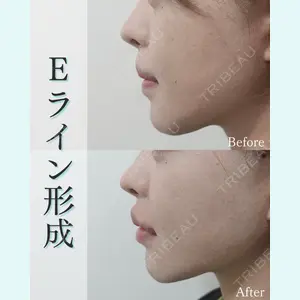 L‘amour clinic Tokyo【ラムールクリニック東京】の症例