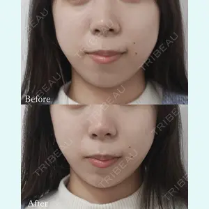 L‘amour clinic Tokyo【ラムールクリニック東京】の症例