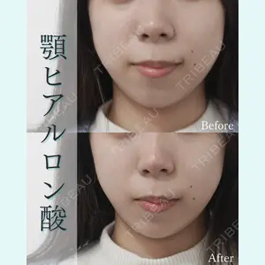 L‘amour clinic Tokyo【ラムールクリニック東京】の症例