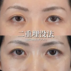 ライブリークリニック 船橋院 坂田 将彰医師の症例