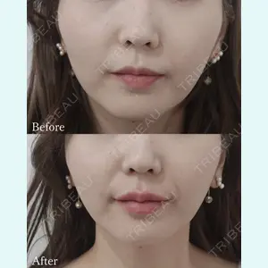 L‘amour clinic Tokyo【ラムールクリニック東京】の症例