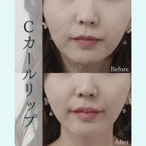 L‘amour clinic Tokyo【ラムールクリニック東京】の症例