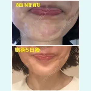 やさしい美容皮膚科・皮フ科　東京浅草院の症例