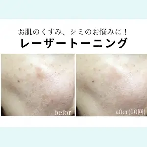 椿クリニック 名古屋院の症例