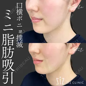 症例