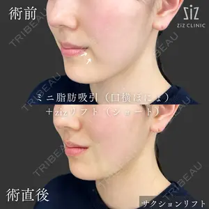 症例