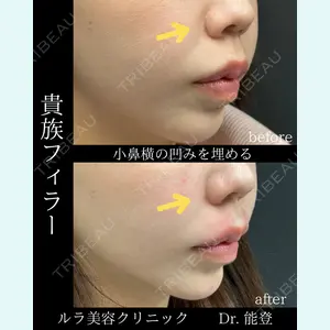 症例