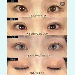 湘南美容クリニック 大阪梅田院 横谷 仁彦医師の症例