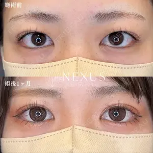 症例
