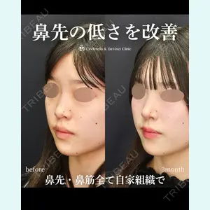 シンデレラ＆ダヴィンチクリニック 宮田 洋佑医師の症例