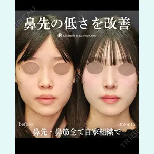 シンデレラ＆ダヴィンチクリニック 宮田 洋佑医師の症例