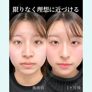 東京シンデレラ美容外科 池袋院 石井 達也医師の症例