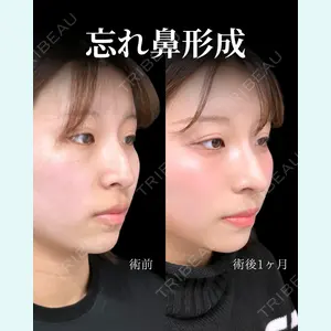症例