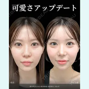 症例