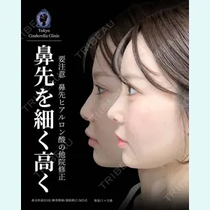 症例