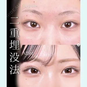 症例