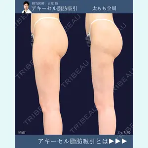 症例