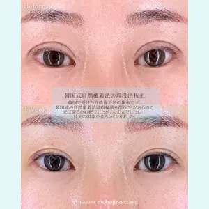 博多もへじのクリニック 村田 将光医師の症例