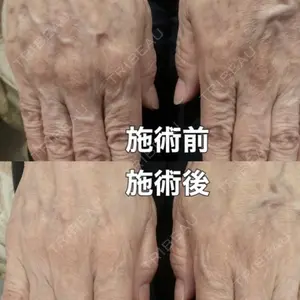やさしい美容皮膚科・皮フ科　秋葉原院の症例