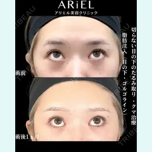 症例