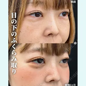 症例