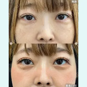 症例