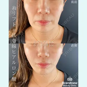 Brandnew Beauty Clinic 平山 容成医師の症例