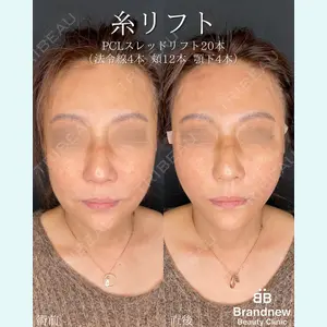 Brandnew Beauty Clinic 平山 容成医師の症例