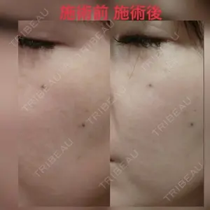 やさしい美容皮膚科・皮フ科　秋葉原院の症例