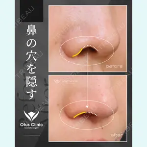 Otus Clinic 【オータスクリニック】 中 徳太郎医師の症例