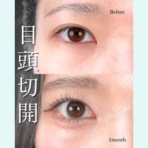東京シンデレラ美容外科 池袋院 山本 紘子医師の症例