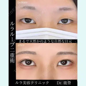 症例