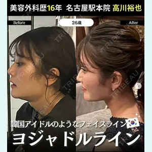 湘南美容クリニック 名古屋駅本院 高川 裕也医師の症例