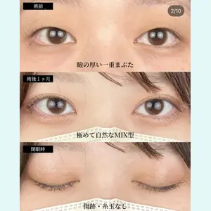 湘南美容クリニック 大阪梅田院の症例