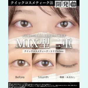 湘南美容クリニック 大阪梅田院の症例
