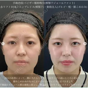 湘南美容クリニック 名古屋駅本院 豊嶋 沙良医師の症例