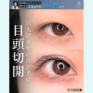 症例