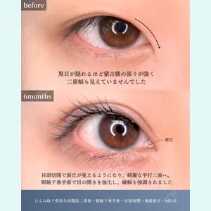 症例