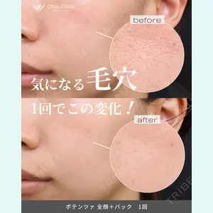症例