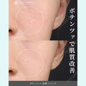 症例